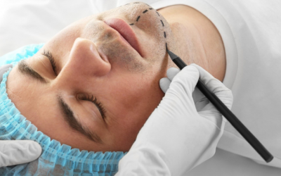 Nam giới chọn phẫu thuật thẩm mỹ vùng nào nhiều nhất? 