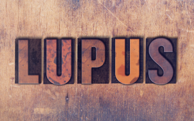 Lupus biến chứng suy thận và những điều bạn cần biết