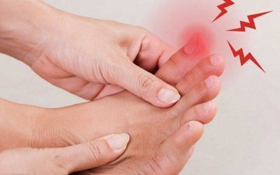Nguyên nhân đằng sau tình trạng gout mạn tính