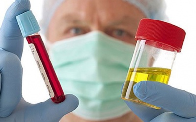 Dấu hiệu cảnh báo ung thư bàng quang