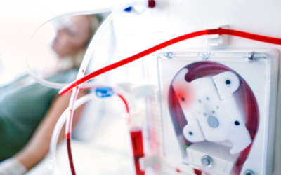 Suy thận độ mấy phải chạy thận?