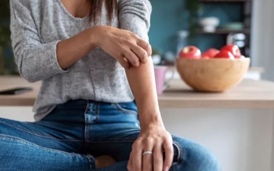 Chế độ ăn uống giúp kiểm soát bệnh chàm