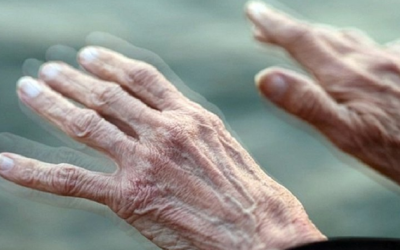 8 dấu hiệu nhận biết sớm bệnh Parkinson 
