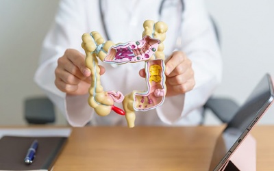 Ung thư đại tràng - Phát hiện sớm, tỉ lệ khỏi bệnh cao 