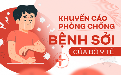 5 việc nên làm để phòng ngừa bệnh sởi