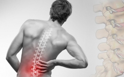 Thoát vị đĩa đệm L4-L5: Mức độ nguy hiểm và cách cải thiện từ thảo dược