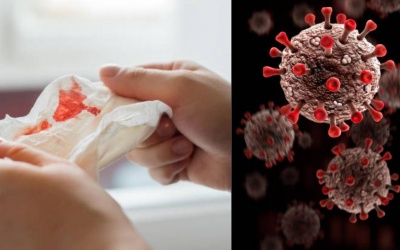 Nga lên tiếng về loại virus 'bí ẩn' gây sốt cao và ho ra máu 
