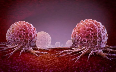 Một chế độ ăn liên quan đến tăng nguy cơ di căn ung thư vú