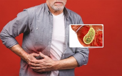 Vôi hoá túi mật là gì và có nguy hiểm không?