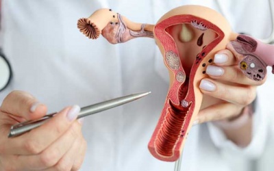 Những điều cần biết về u xơ tử cung 50mm