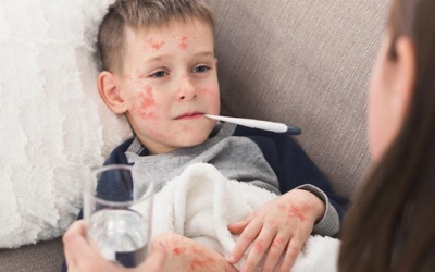 Sởi tiềm ẩn nhiều biến chứng nguy hiểm