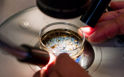 Hạt vi nhựa có trong dịch nang buồng trứng ở người