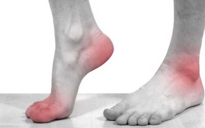 Triệu chứng cảnh báo bệnh gout và giải pháp cải thiện hiệu quả