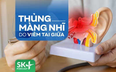 Podcast: Thủng màng nhĩ do viêm tai giữa