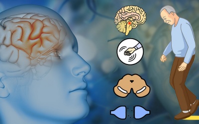 7 tác nhân làm tăng nguy cơ mắc bệnh Parkinson