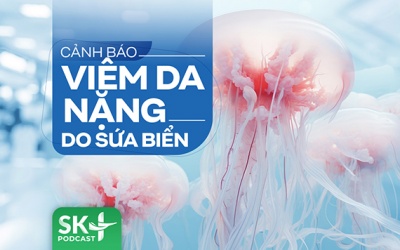 Podcast: Cảnh báo viêm da nặng do sứa biển
