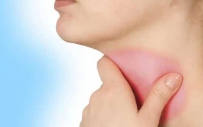 Mẹo cải thiện viêm thanh quản tại nhà hiệu quả