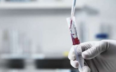 Chẩn đoán bệnh Celiac nhờ xét nghiệm máu