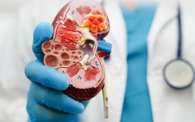 Suy thận giai đoạn cuối - Những điều bạn cần biết!