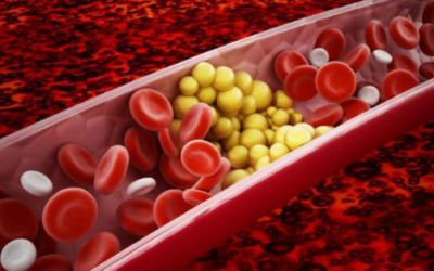 'Điểm danh' những loại quả quen thuộc giúp làm giảm cholesterol