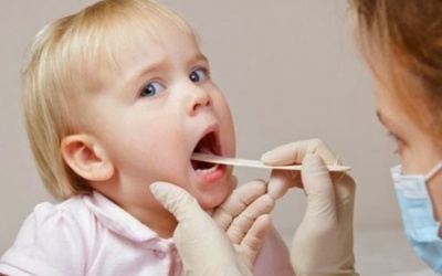 Làm thế nào để ngăn ngừa viêm amidan cho trẻ?