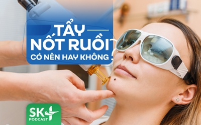 Podcast: Tẩy nốt ruồi có nên hay không?