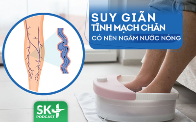 Podcast: Suy giãn tĩnh mạch chân có nên ngâm nước nóng?