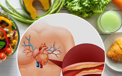 Mỡ máu cao có thể kiểm soát nhờ 4 thói quen lành mạnh