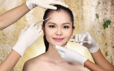 Giải đáp những thắc mắc xung quanh việc tiêm filler