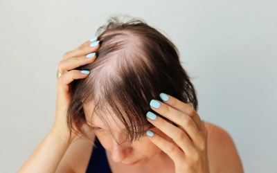 Mách bạn 5 cách giảm rụng tóc hiệu quả