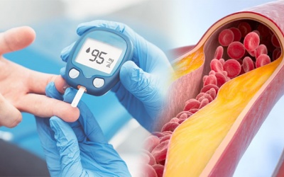 Tại sao người bệnh đái tháo đường hay bị xơ vữa động mạch?