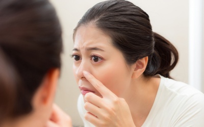 Vì sao không nên nặn mụn trong vùng “tam giác tử thần”?