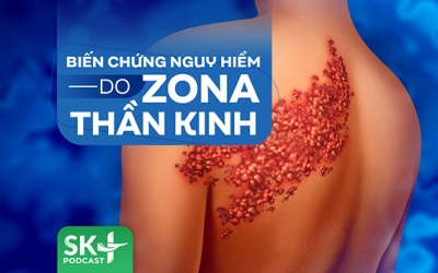 Podcast: Biến chứng nguy hiểm do Zona thần kinh