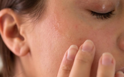 Cơ thể thiếu nước ảnh hưởng thế nào tới làn da?