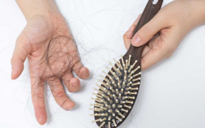 Rượu, nước ngọt và nguy cơ rụng tóc