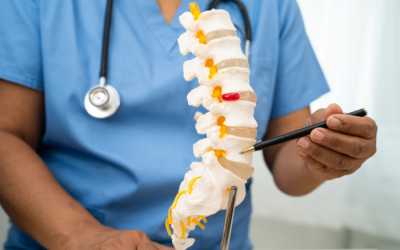 Không chủ quan khi thoát vị đĩa đệm L4 L5 chèn ép dây thần kinh