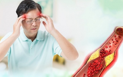 Mỡ máu cao là do đâu?