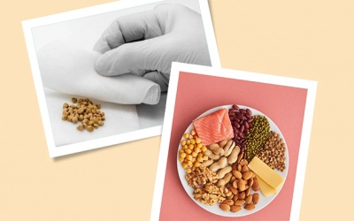 Sỏi cholesterol 18mm cần có chế độ ăn như thế nào?