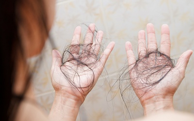 12 “thủ phạm” giấu mặt gây rụng tóc