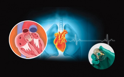 Có cách nào để trì hoãn thay van tim?