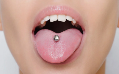 Xỏ khuyên lưỡi ảnh hưởng thế nào tới sức khoẻ răng miệng 