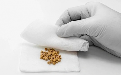 Có sỏi túi mật 5mm nên điều trị thế nào?