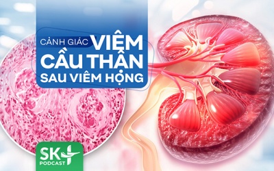 Podcast: Cảnh giác viêm cầu thận sau viêm họng
