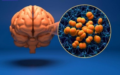 Hà Nội phát hiện ca mắc bệnh não mô cầu thứ 3 trong năm 