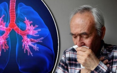 Người bị viêm phổi mạn tính nên điều trị như thế nào?