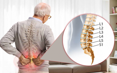 Dấu hiệu nhận biết thoái hóa đốt sống lưng L5 S1 không nên bỏ qua