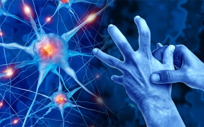 Run tay chân do thoái hóa não, dùng thuốc không cải thiện phải làm sao?