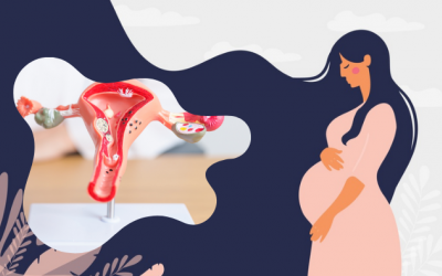 Bị nhân xơ tử cung có thai được không?