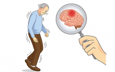 Bị run tay do thoái hóa chất trắng có dùng TPBVSK Vương Lão Kiện được không?