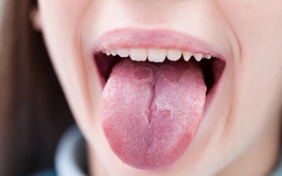 Thủ phạm “quen mặt” tăng nguy cơ ung thư miệng lên 50%